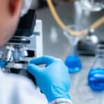 Stem cell, diabetes